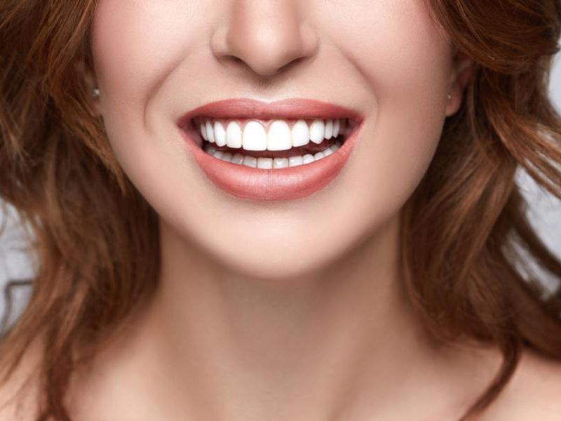 teeth whitening services in chattanooga